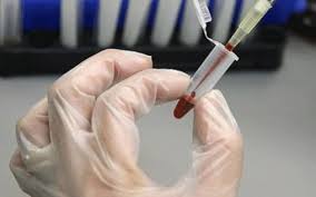 ذخیره ۴۰۰۰ نمونه خون بند ناف در بانک خون بندناف رویان آذربایجان غربی